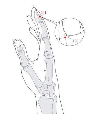 1gi-2.jpg