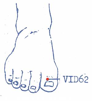 vi-d62.jpg