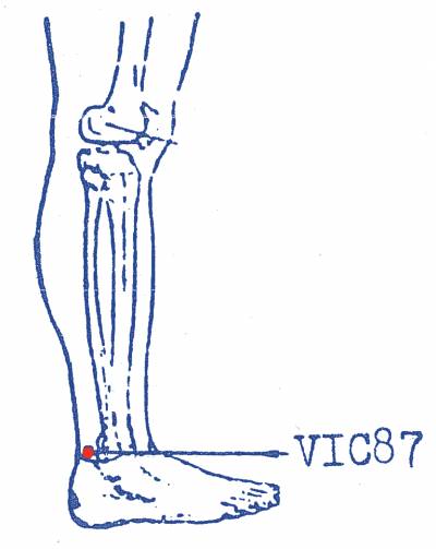 vi-c87.jpg