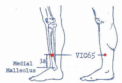 vi-c65.jpg