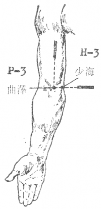 Wu Zuren 1976